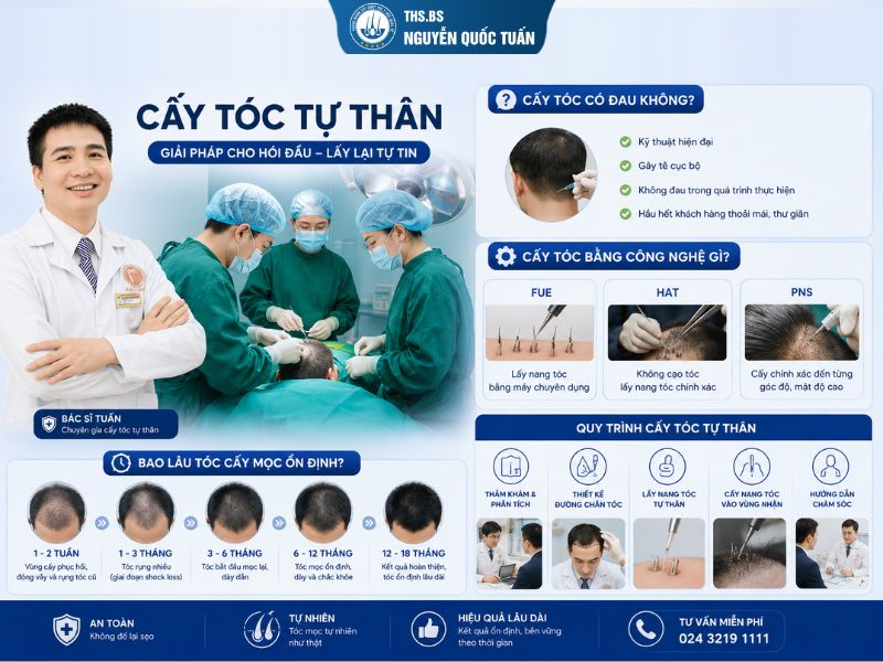 Khi nào nên cấy tóc thay vì tiếp tục điều trị bảo tồn 
