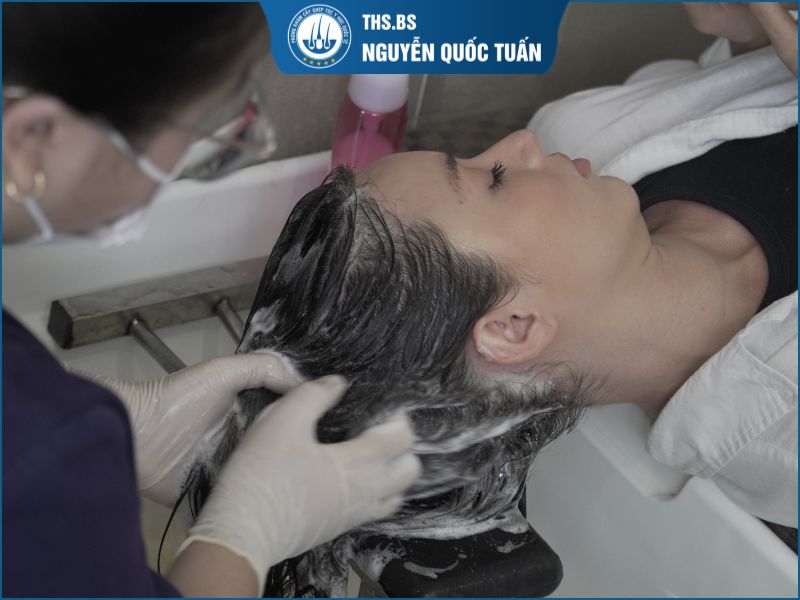 Sau cấy tóc 1 tháng nên chăm sóc như thế nào? 