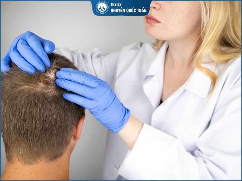 Điều trị bệnh lý gây rụng tóc 