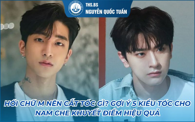 hói chữ m để kiểu tóc gì