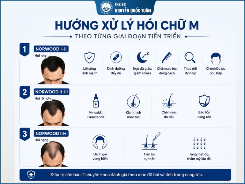 Hướng xử lý hói chữ M theo từng giai đoạn tiến triển