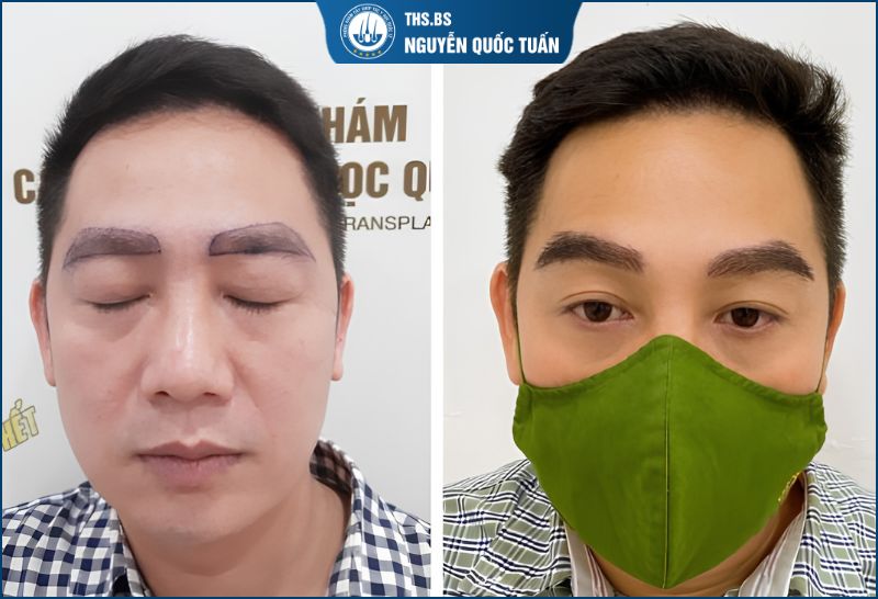 Đánh giá thực tế của khách hàng sau khi cấy lông mày 