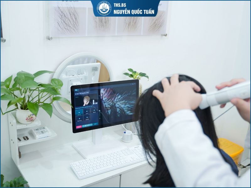 Khi nào người hói chữ M nên cấy tóc 
