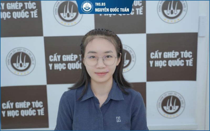 Khi nào người bị hói chữ M cần cấy tóc?