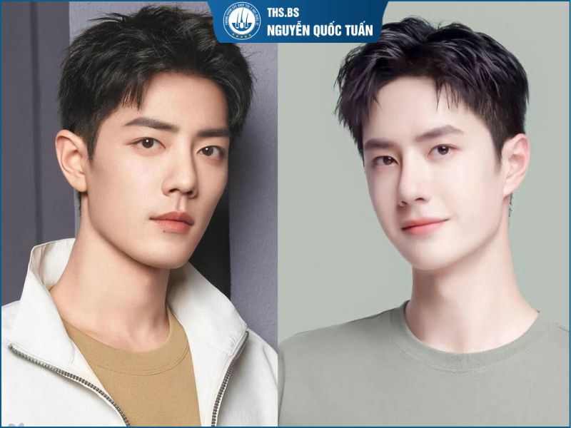 Side part vuốt lệch