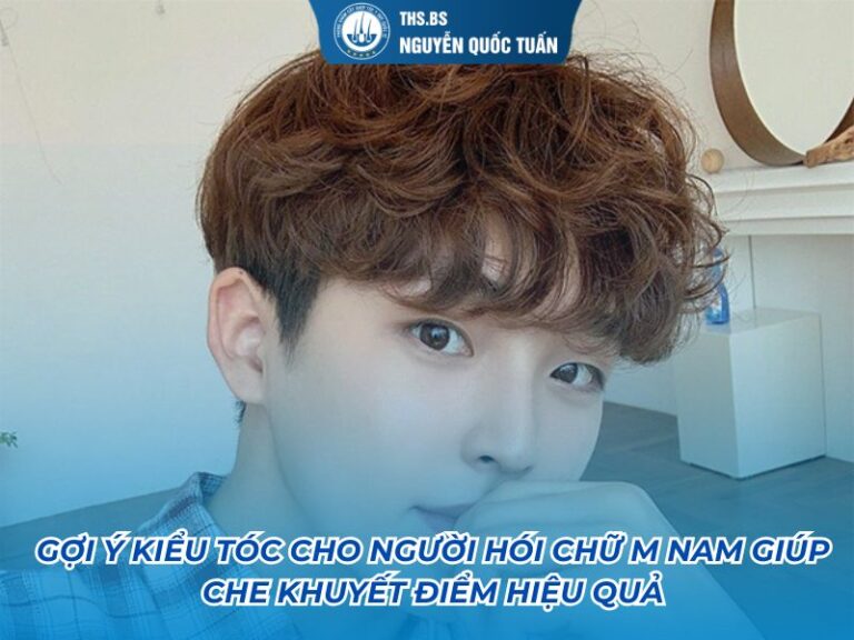kiểu tóc cho người hói chữ m nam