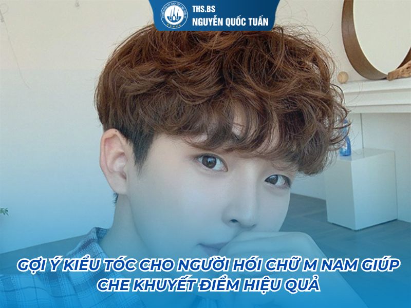 kiểu tóc cho người hói chữ m nam