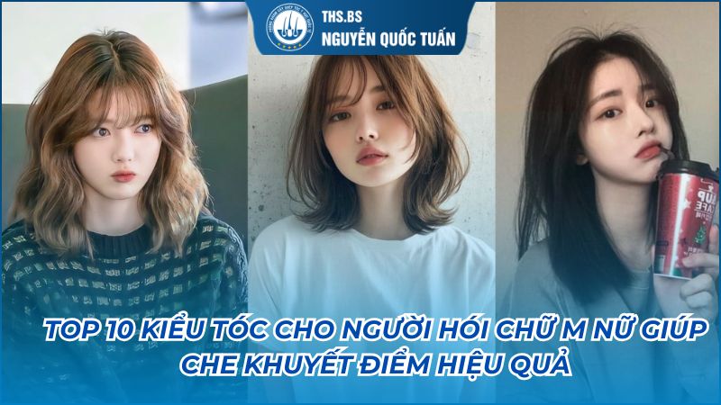 kiểu tóc cho người hói chữ m nữ