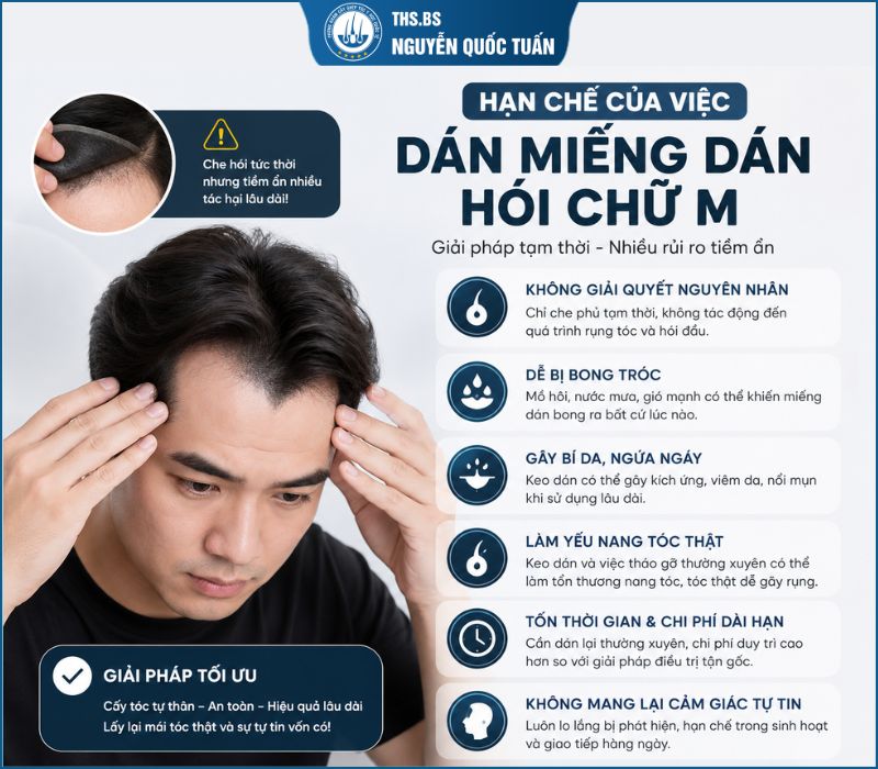Hạn chế miếng dán hói chữ M