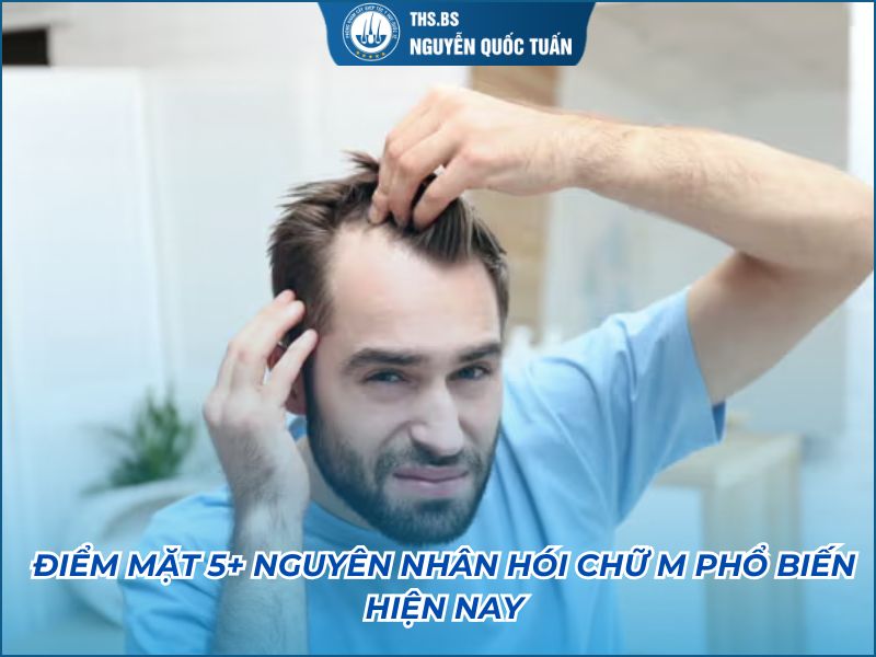 nguyên nhân hói chữ M