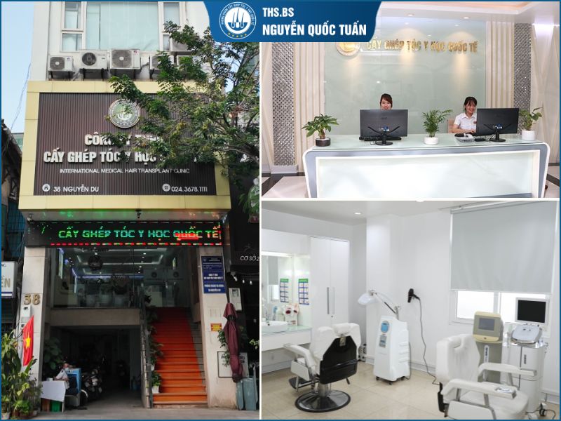 Cấy tóc Nguyễn Du ở đâu? Có uy tín không? 