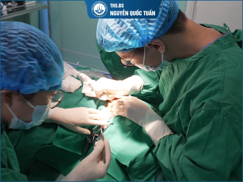Cấy lông vùng kín được thực hiện như thế nào? 