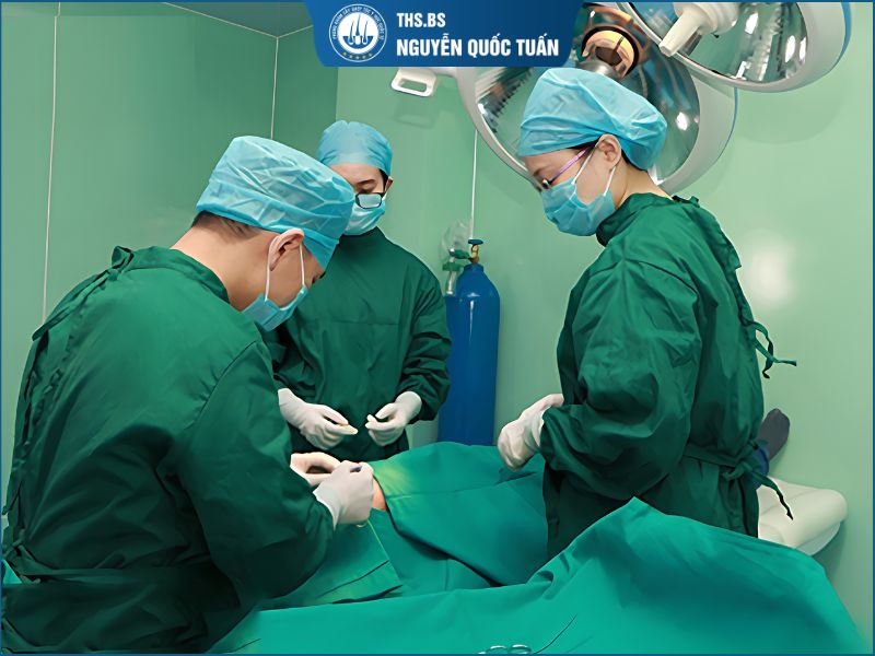 Cấy tóc tự thân cho nữ bị hói chữ M 