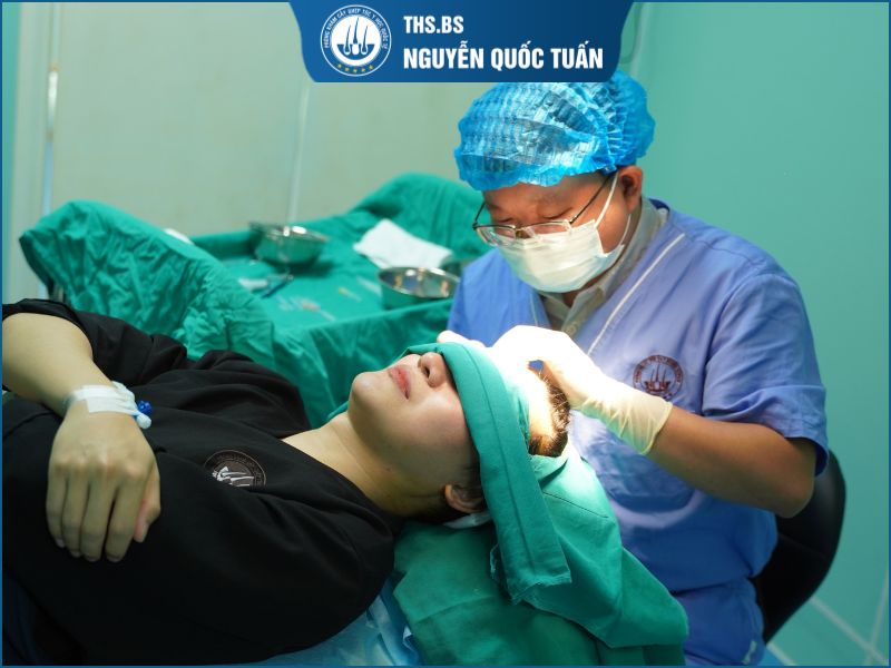 Quy trình cấy tóc chuẩn y khoa  
