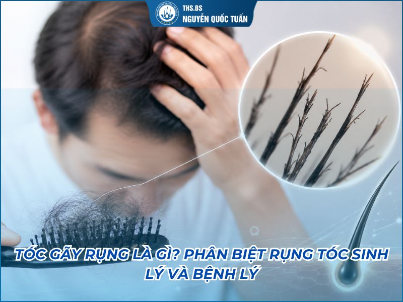 tóc gãy rụng là gì