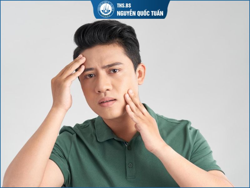 Đối tượng phù hợp với phương pháp cấy râu quai nón 