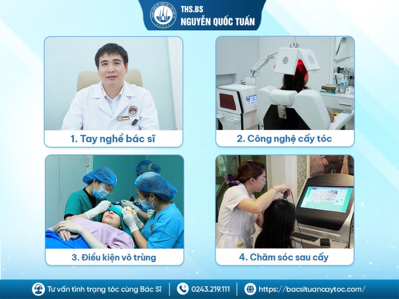 Những yếu tố ảnh hưởng trực tiếp đến kết quả cấy tóc