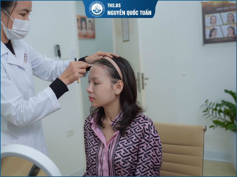 Yếu tố quyết định chi phí cấy tóc sợi dài 