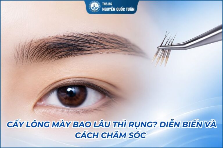 cấy lông mày bao lâu rụng