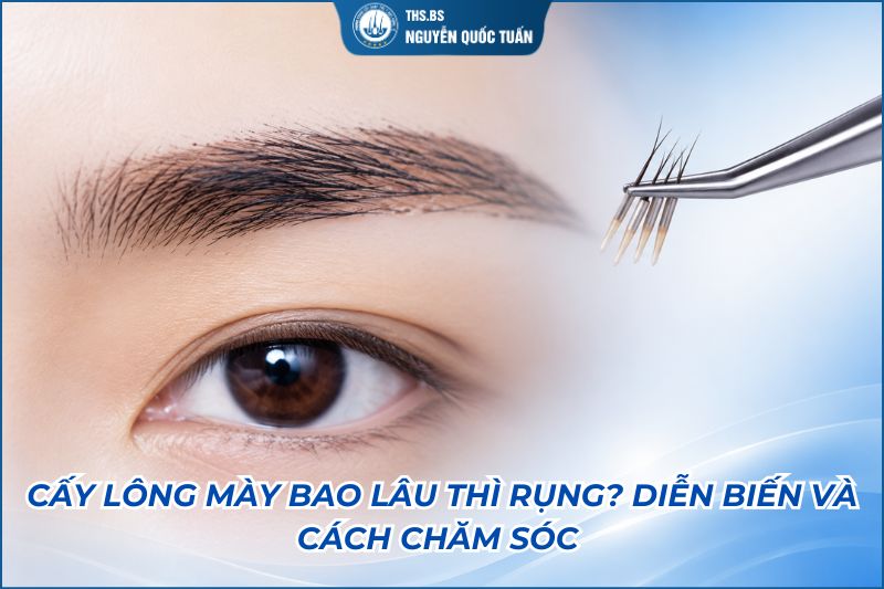 cấy lông mày bao lâu rụng