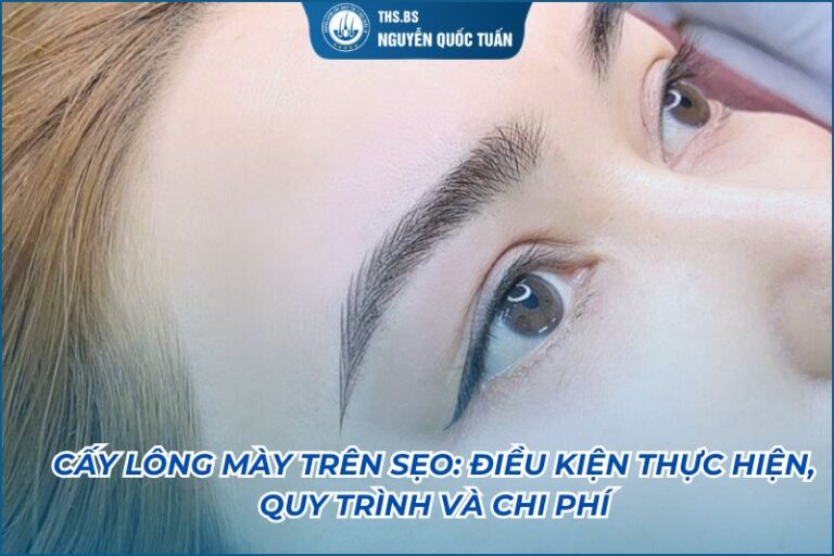 cấy lông mày trên sẹo