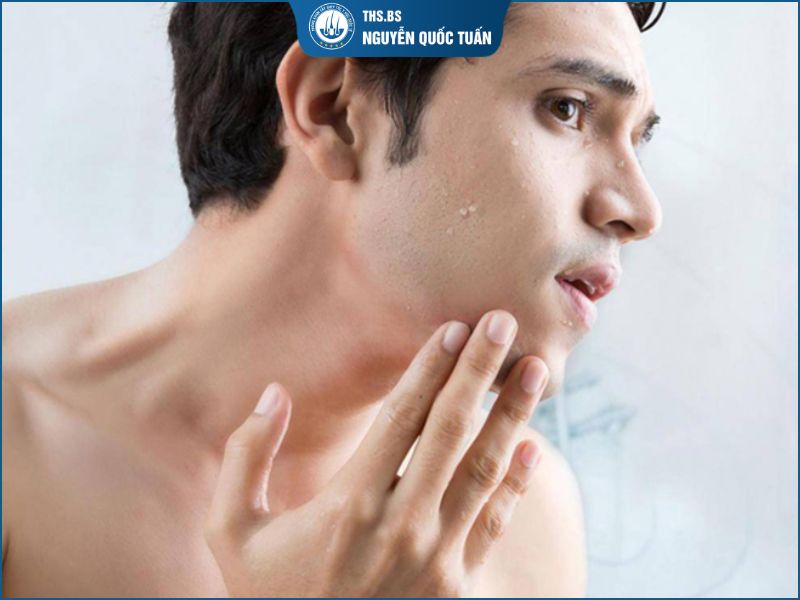 Trường hợp nên cấy râu  