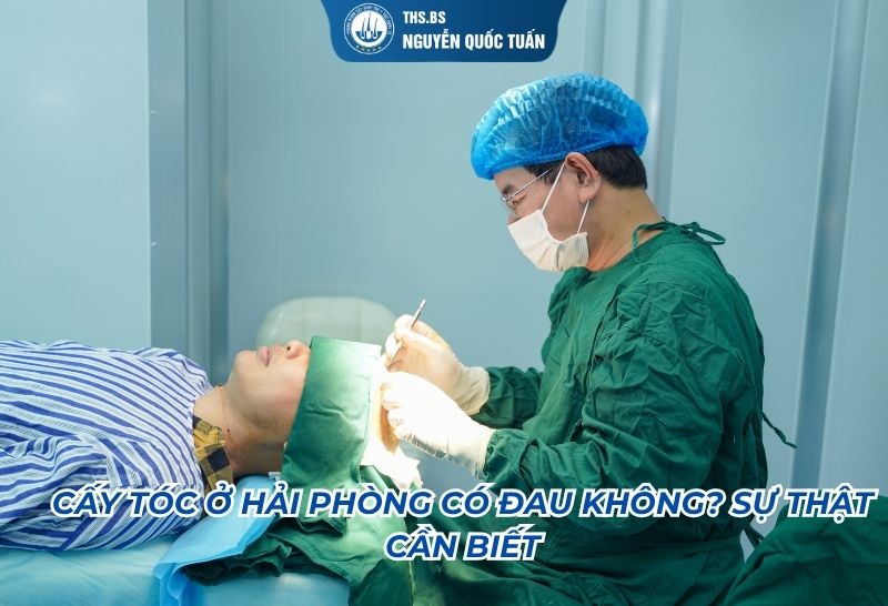 cấy tóc hải phòng có đau không