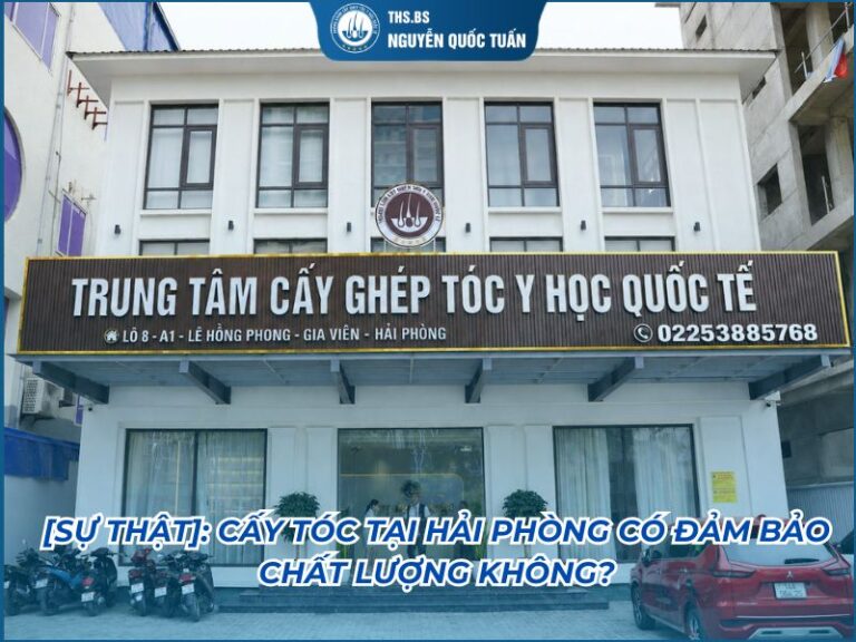 cấy tóc tại hải phòng