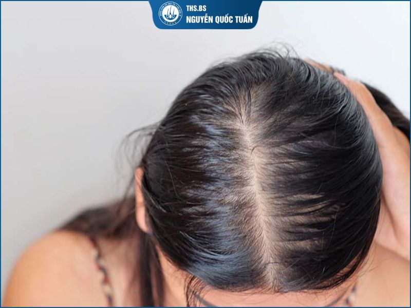 Dấu hiệu nhận biết đường rẽ ngôi nữ 