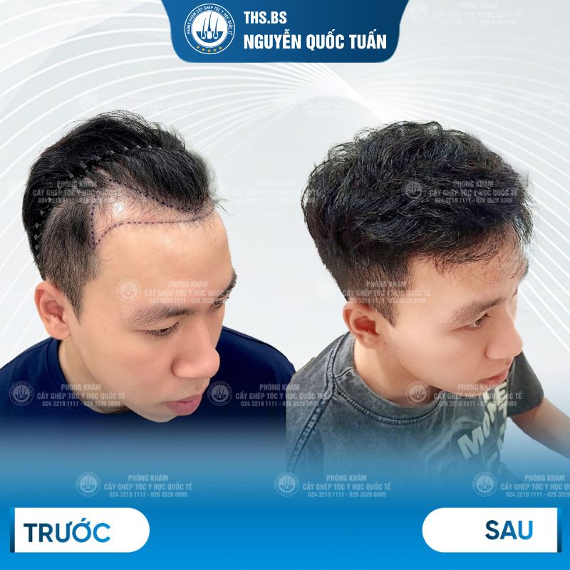 Hành trình thay đổi diện mạo: Kết quả thực tế và đánh giá từ khách hàng 