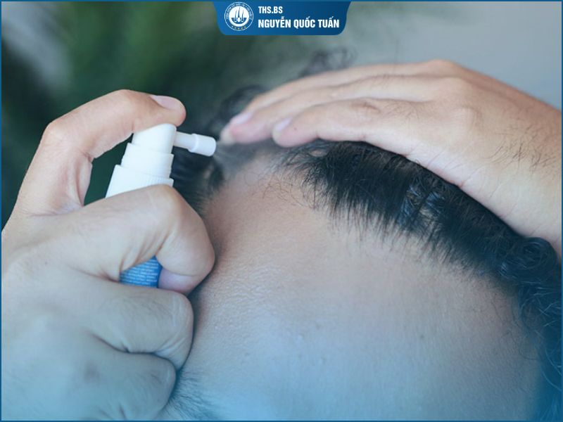 Điều trị bằng thuốc 