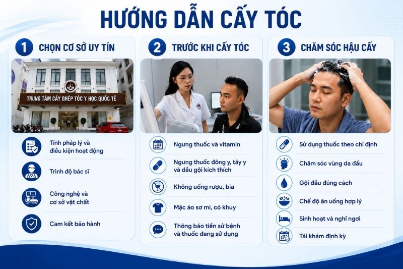 Cấy tóc ở Hải Phòng cần lưu ý những gì 