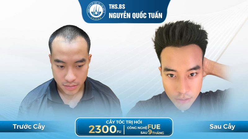 Tham khảo kết quả thực tế thay vì chỉ nhìn vào quảng cáo 