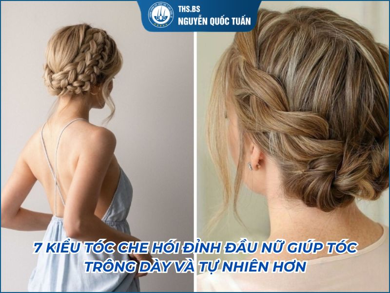 kiểu tóc che hói đỉnh đầu