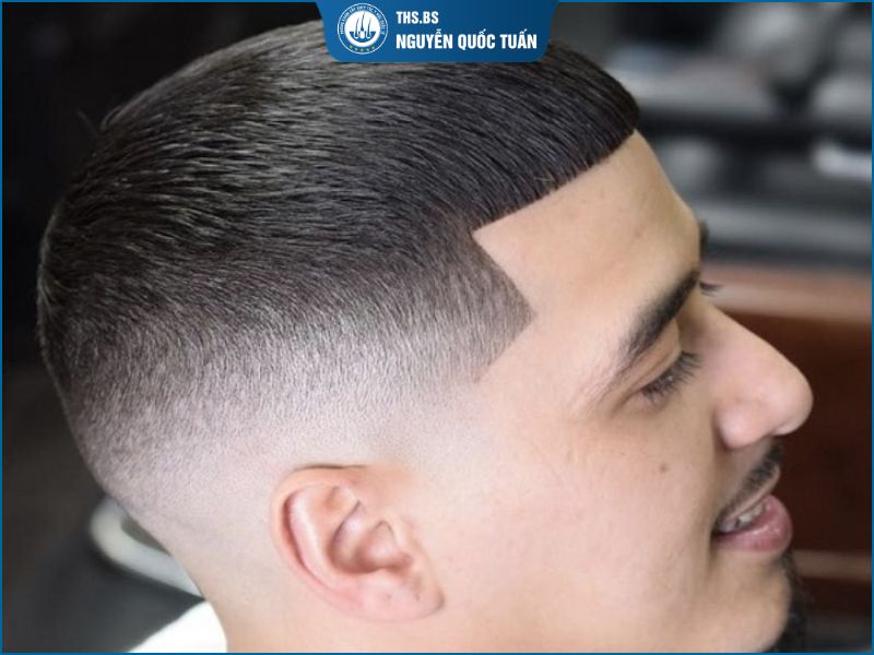 Buzz Cut 