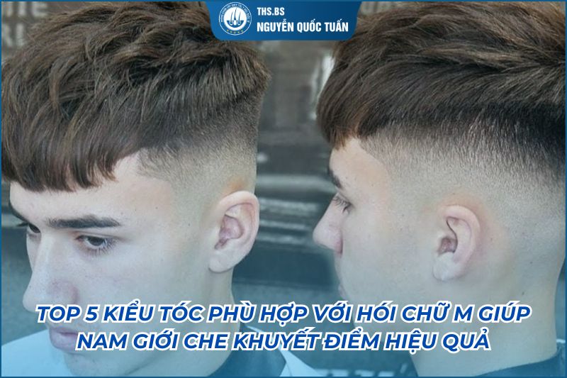 kiểu tóc hợp hói chữ M