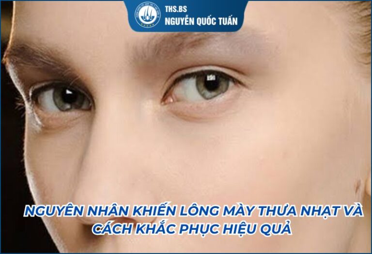 nguyên nhân khiến lông mày thưa'