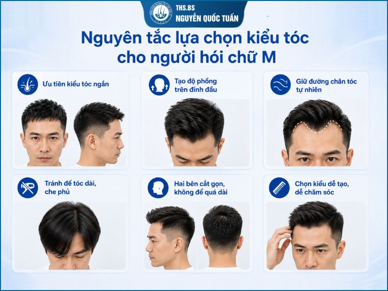 Nguyên tắc lựa chọn kiểu tóc cho người hói chữ M  