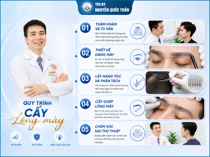 Quy trình cấy lông mày bị sẹo