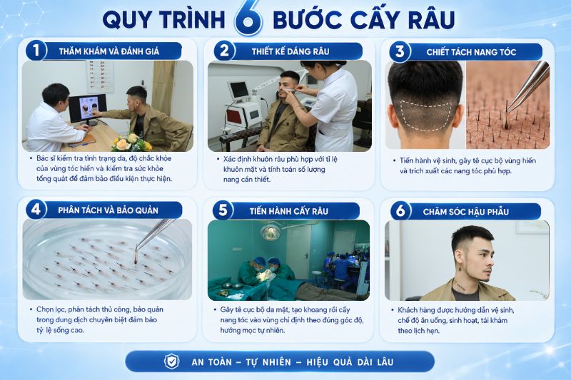 Quy trình cấy râu cho nam chuẩn y khoa 
