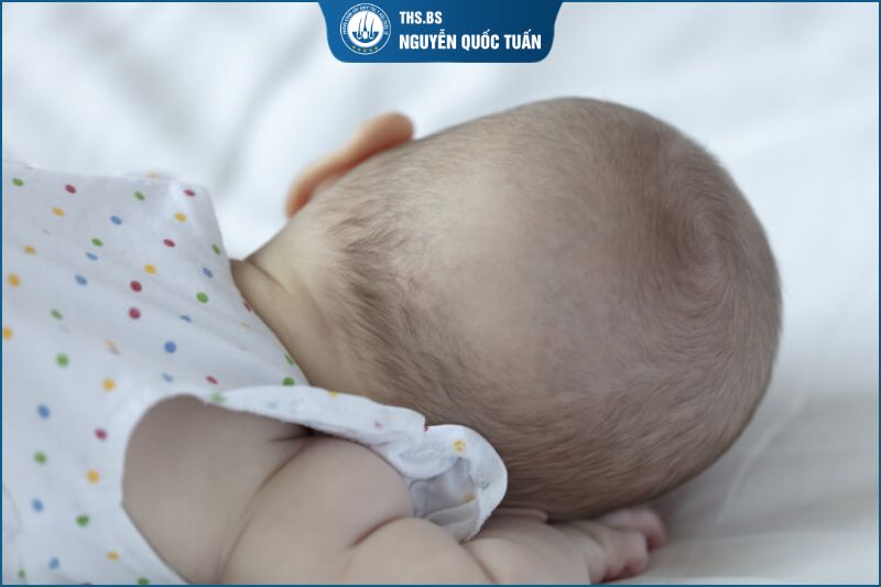 Rụng tóc vành khăn là gì 