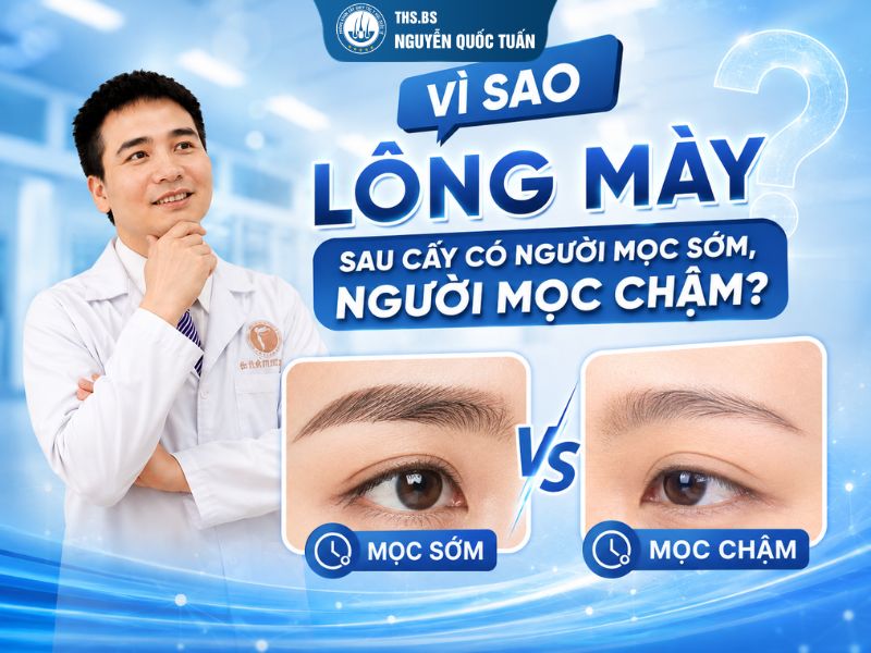 Vì sao lông mày sau cấy có người mọc sớm, người mọc chậm?