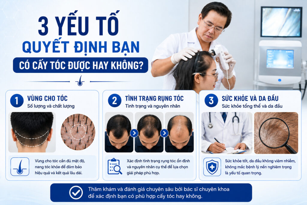  Điều kiện nào quyết định bạn có cấy tóc được hay không? 