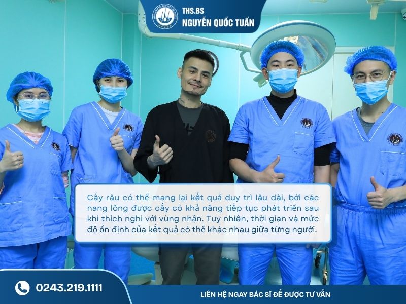 Cấy râu duy trì được bao lâu  