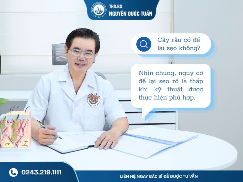 Cấy râu có để lại sẹo không 