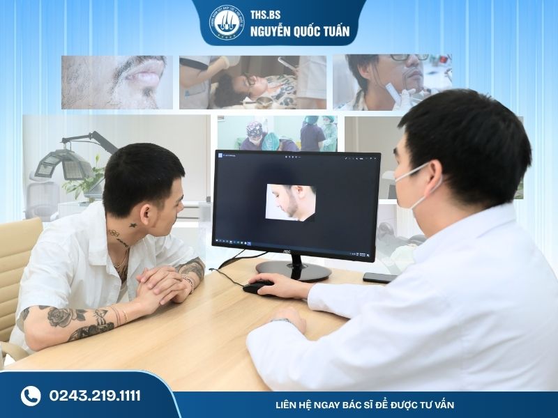  Cấy râu phù hợp với những ai 