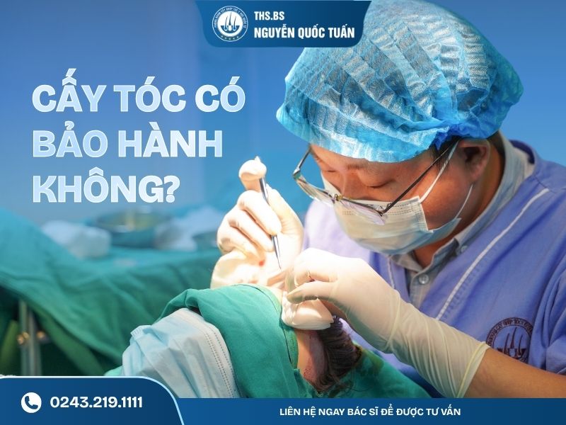 cấy tóc có bảo hành không
