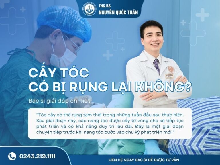 cấy tóc có bị rụng lại không