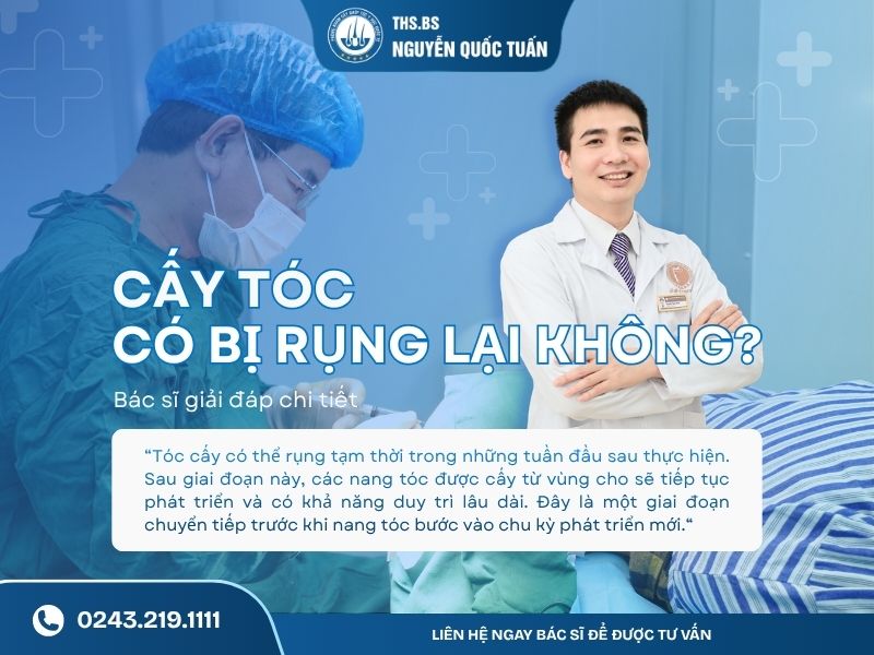cấy tóc có bị rụng lại không