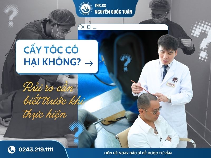 cấy tóc có hại không